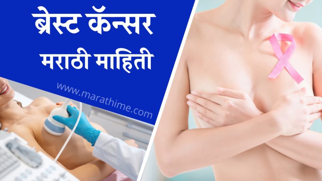 ब्रेस्ट कॅन्सर मराठी माहिती, Breast Cancer Information in Marathi