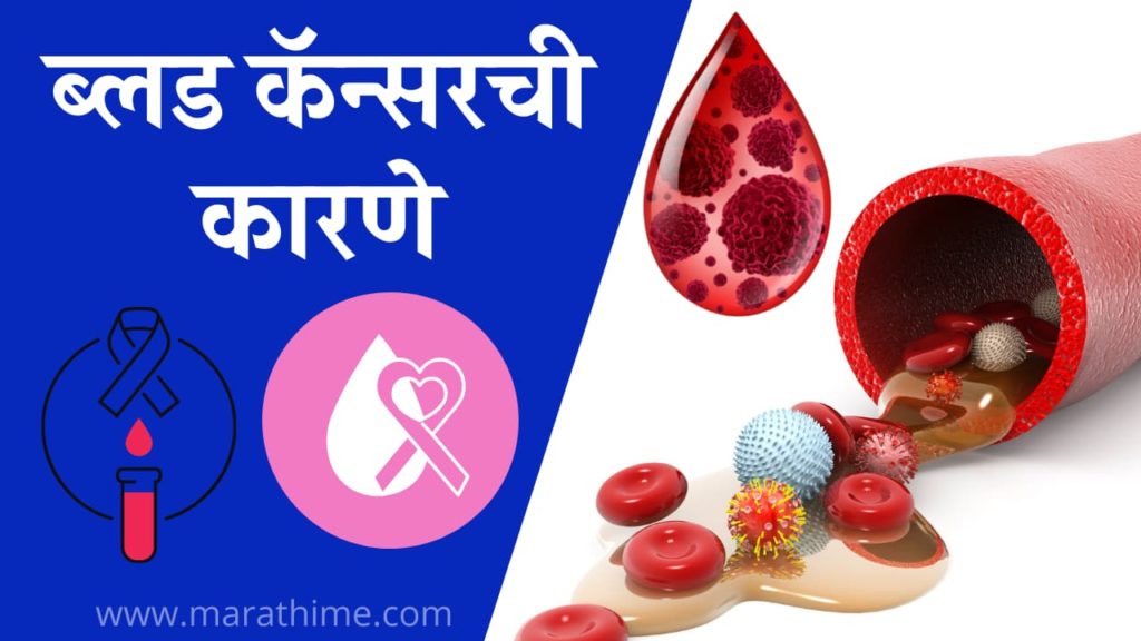 ब्लड कॅन्सरची कारणे, Causes of Blood Cancer in Marathi